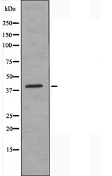 CACNG7 Antibody - Western blot analysis of extracts of HepG2 cells using CACNG7 antibody.