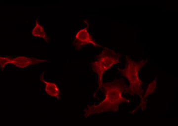 CACNG7 Antibody - Staining HepG2 cells by IF/ICC. The samples were fixed with PFA and permeabilized in 0.1% Triton X-100, then blocked in 10% serum for 45 min at 25°C. The primary antibody was diluted at 1:200 and incubated with the sample for 1 hour at 37°C. An Alexa Fluor 594 conjugated goat anti-rabbit IgG (H+L) Ab, diluted at 1/600, was used as the secondary antibody.