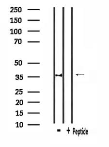 CACNG7 Antibody - Western blot analysis of extracts of rat heart tissue using CACNG7 antibody.