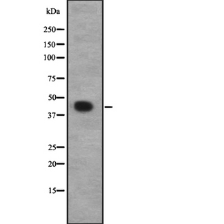 CACNG8 Antibody - Western blot analysis of CACNG8 expression in HEK293 cells. The lane on the left is treated with the antigen-specific peptide.