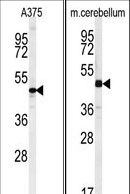 CACUL1 / Cullin Antibody - (LEFT)Western blot of C10orf46 Antibody in A375 cell line lysates (35 ug/lane). C10orf46 (arrow) was detected using the purified antibody. (RIGHT)Western blot of C10orf46 Antibody in mouse cerebellum tissue lysates (35 ug/lane). C10orf46 (arrow) was detected using the purified antibody.