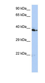 CACUL1 / Cullin Antibody - C10orf46 antibody Western blot of HT1080 cell lysate. This image was taken for the unconjugated form of this product. Other forms have not been tested.