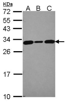 CACYBP Antibody - Sample (30 ug of whole cell lysate). A:293T, B: A431 , C: JurKat. 12% SDS PAGE. CACYBP antibody diluted at 1:5000.