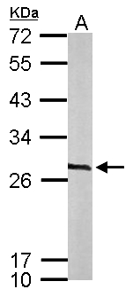 CACYBP Antibody - Sample (50 ug of whole cell lysate). A: mouse brain. 12% SDS PAGE. CACYBP antibody diluted at 1:1000.