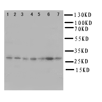 CACYBP Antibody - WB of CACYBP antibody. Lane 1: Rat Liver Tissue Lysate. Lane 2: Rat Brain Tissue Lysate. Lane 3: Rat Spleen Tissue Lysate. Lane 4: SMMC Cell Lysate. Lane 5: COLO320 Cell Lysate. Lane 6: SW620 Cell Lysate. Lane 7: 293T Cell Lysate.