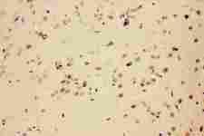 CACYBP Antibody - Anti-CACYBP antibody,IHC(P): Rat Brain Tissue