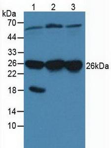 CACYBP Antibody - Western Blot; Sample: Lane1: Porcine Brain Tissue; Lane2: Human Hela Cells; Lane3: Human A431 Cells.
