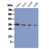 CACYBP Antibody - The cell lysates of HeLa, 293T, Jurkat and A549(40ug) were resolved by SDS-PAGE, transferred to PVDF membrane and probed with anti-human CACYBP antibody (1:1000). Proteins were visualized using a goat anti-mouse secondary antibody conjugated to HRP and an ECL detection system.