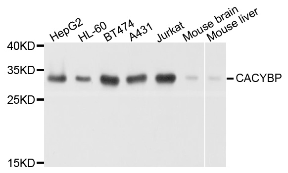 CACYBP Antibody - Western blot analysis of extract of various cells.
