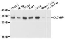 CACYBP Antibody - Western blot analysis of extract of various cells.