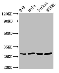 CACYBP Antibody - Positive Western Blot detected in 293 whole cell lysate, Hela whole cell lysate, Jurkat whole cell lysate, HUVEC whole cell lysate. All lanes: CACYBP antibody at 2.7 µg/ml Secondary Goat polyclonal to rabbit IgG at 1/50000 dilution. Predicted band size: 27, 21, 9 KDa. Observed band size: 27 KDa