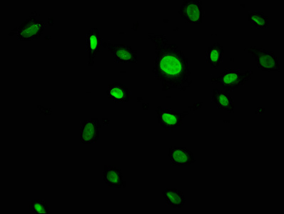 CACYBP Antibody - Immunofluorescence staining of U251 cells with CACYBP Antibody at 1:133, counter-stained with DAPI. The cells were fixed in 4% formaldehyde, permeabilized using 0.2% Triton X-100 and blocked in 10% normal Goat Serum. The cells were then incubated with the antibody overnight at 4°C. The secondary antibody was Alexa Fluor 488-congugated AffiniPure Goat Anti-Rabbit IgG(H+L).