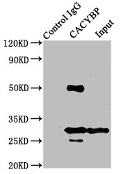 CACYBP Antibody - Immunoprecipitating CACYBP in Hela whole cell lysate Lane 1: Rabbit control IgG instead of CACYBP Antibody in Hela whole cell lysate.For western blotting, a HRP-conjugated Protein G antibody was used as the secondary antibody (1/2000) Lane 2: CACYBP Antibody (8µg) + Hela whole cell lysate (500µg) Lane 3: Hela whole cell lysate (10µg)