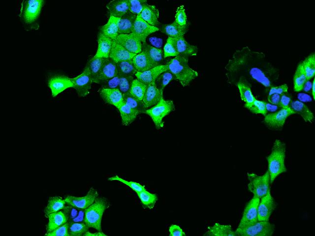 CACYBP Antibody - Immunofluorescence staining of CACYBP in A431 cells. Cells were fixed with 4% PFA, permeabilzed with 0.1% Triton X-100 in PBS, blocked with 10% serum, and incubated with rabbit anti-Human CACYBP polyclonal antibody (dilution ratio 1:200) at 4°C overnight. Then cells were stained with the Alexa Fluor 488-conjugated Goat Anti-rabbit IgG secondary antibody (green) and counterstained with DAPI (blue). Positive staining was localized to Cytoplasm and nucleus.