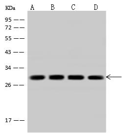 CACYBP Antibody - Anti-CACYBP rabbit polyclonal antibody at 1:2000 dilution. Lane A: MCF7 Whole Cell Lysate. Lane B: HeLa Whole Cell Lysate. Lane C: 293T Whole Cell Lysate. Lane D: U 251MG Whole Cell Lysate. Lysates/proteins at 30 ug per lane. Secondary: Goat Anti-Rabbit IgG (H+L)/HRP at 1/10000 dilution. Developed using the ECL technique. Performed under reducing conditions. Predicted band size: 26 kDa. Observed band size: 28 kDa.