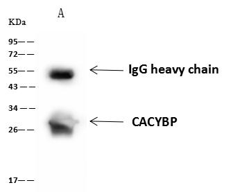 CACYBP Antibody - CACYBP was immunoprecipitated using: Lane A: 0.5 mg HeLa Whole Cell Lysate. 4 uL anti-CACYBP rabbit polyclonal antibody and 60 ug of Immunomagnetic beads Protein A/G. Primary antibody: Anti-CACYBP rabbit polyclonal antibody, at 1:100 dilution. Secondary antibody: Goat Anti-Rabbit IgG (H+L)/HRP at 1/10000 dilution. Developed using the ECL technique. Performed under reducing conditions. Predicted band size: 26 kDa. Observed band size: 30 kDa.