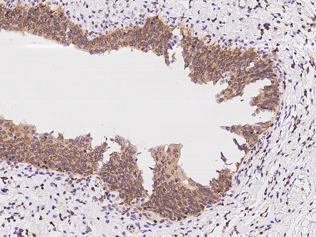 CACYBP Antibody - Immunochemical staining of human CACYBP in human urinary bladder with rabbit polyclonal antibody at 1:500 dilution, formalin-fixed paraffin embedded sections.