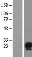 CACYBP Protein - Western validation with an anti-DDK antibody * L: Control HEK293 lysate R: Over-expression lysate