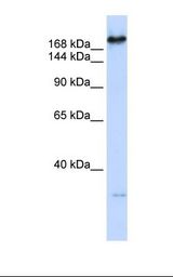 CAD Antibody - Fetal lung lysate. Antibody concentration: 1.0 ug/ml. Gel concentration: 6-18%.  This image was taken for the unconjugated form of this product. Other forms have not been tested.