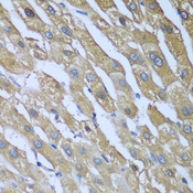 CAD Antibody - Immunohistochemistry of paraffin-embedded human liver tissue.