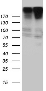 CAD Antibody - HEK293T cells were transfected with the pCMV6-ENTRY control. (Left lane) or pCMV6-ENTRY CAD. (Right lane) cDNA for 48 hrs and lysed. Equivalent amounts of cell lysates. (5 ug per lane) were separated by SDS-PAGE and immunoblotted with anti-CAD rabbit polyclonal antibody.