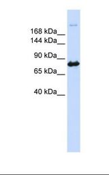 CAD Antibody - 293T cell lysate. Anti-CAD Antibody concentration: 1.0 ug/ml. Gel concentration: 6-18%.  This image was taken for the unconjugated form of this product. Other forms have not been tested.