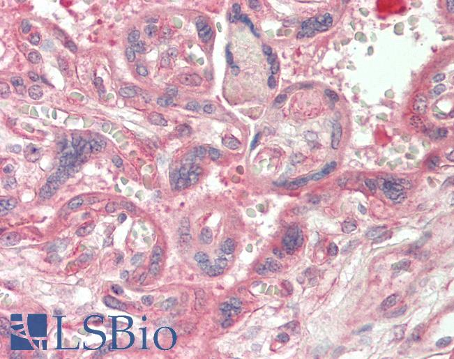CAD Antibody - Human Placenta: Formalin-Fixed, Paraffin-Embedded (FFPE).  This image was taken for the unconjugated form of this product. Other forms have not been tested.