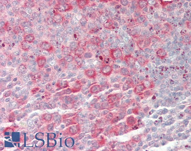 CAD Antibody - Human Tonsil: Formalin-Fixed, Paraffin-Embedded (FFPE).  This image was taken for the unconjugated form of this product. Other forms have not been tested.