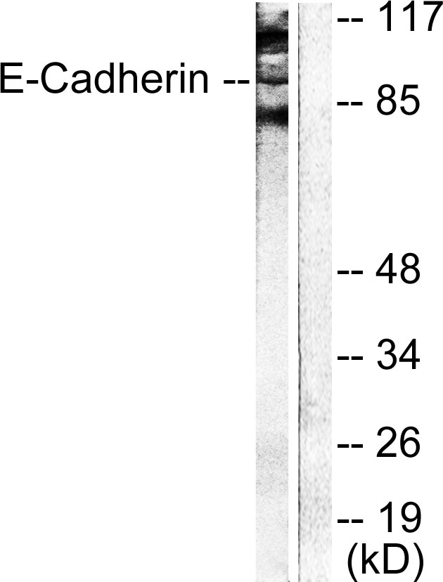 Cadherin Antibody - Western blot analysis of lysates from NIH/3T3 cells, using Cadherin-pan Antibody. The lane on the right is blocked with the synthesized peptide.