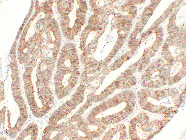 Cadherin Antibody - Colon Carcinoma