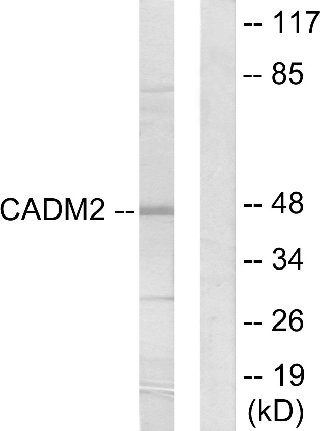 CADM2 Antibody - Western blot analysis of lysates from HepG2 cells, using CADM2 Antibody. The lane on the right is blocked with the synthesized peptide.