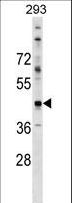 CADM2 Antibody - CADM2 Antibody western blot of 293 cell line lysates (35 ug/lane). The CADM2 antibody detected the CADM2 protein (arrow).