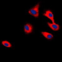 CADM2 Antibody - Immunofluorescent analysis of CADM2 staining in HepG2 cells. Formalin-fixed cells were permeabilized with 0.1% Triton X-100 in TBS for 5-10 minutes and blocked with 3% BSA-PBS for 30 minutes at room temperature. Cells were probed with the primary antibody in 3% BSA-PBS and incubated overnight at 4 deg C in a humidified chamber. Cells were washed with PBST and incubated with a DyLight 594-conjugated secondary antibody (red) in PBS at room temperature in the dark. DAPI was used to stain the cell nuclei (blue).