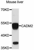CADM2 Antibody - Western blot analysis of extracts of mouse liver, using CADM2 antibody at 1:3000 dilution. The secondary antibody used was an HRP Goat Anti-Rabbit IgG (H+L) at 1:10000 dilution. Lysates were loaded 25ug per lane and 3% nonfat dry milk in TBST was used for blocking. An ECL Kit was used for detection and the exposure time was 90s.