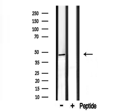 CADM2 Antibody - Western blot analysis of extracts of rat brain using CADM2 antibody.