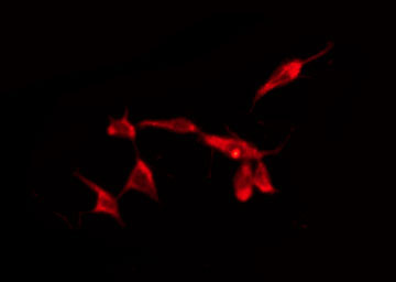 CADM2 Antibody - Staining HepG2 cells by IF/ICC. The samples were fixed with PFA and permeabilized in 0.1% Triton X-100, then blocked in 10% serum for 45 min at 25°C. The primary antibody was diluted at 1:200 and incubated with the sample for 1 hour at 37°C. An Alexa Fluor 594 conjugated goat anti-rabbit IgG (H+L) Ab, diluted at 1/600, was used as the secondary antibody.