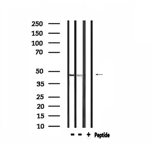 CADM2 Antibody - Western blot analysis of extracts of HepG2, mouse brain tissue using CADM2 antibody.