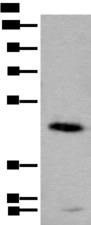 CADM2 Antibody - Western blot analysis of Human cerebella tissue lysate  using CADM2 Polyclonal Antibody at dilution of 1:2000