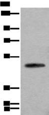 CADM2 Antibody - Western blot analysis of Human cerebella tissue lysate  using CADM2 Polyclonal Antibody at dilution of 1:2000