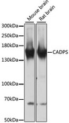 CADPS Antibody - Western blot analysis of extracts of various cell lines, using CADPS antibody at 1:3000 dilution. The secondary antibody used was an HRP Goat Anti-Rabbit IgG (H+L) at 1:10000 dilution. Lysates were loaded 25ug per lane and 3% nonfat dry milk in TBST was used for blocking. An ECL Kit was used for detection and the exposure time was 30s.