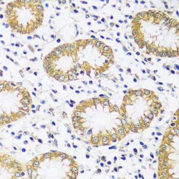 CADPS Antibody - Immunohistochemistry of paraffin-embedded Human stomach using CADPS Polyclonal Antibody at dilution of 1:100 (40x lens).