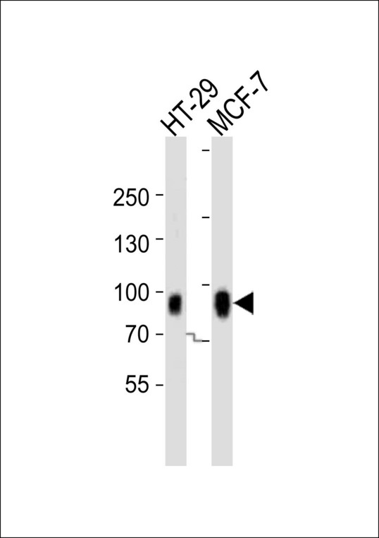CAGE1 / Cancer Antigen 1 Antibody - Western blot of lysates from HT-29, MCF-7 cell line (from left to right) with CAGE1 Antibody. Antibody was diluted at 1:1000 at each lane. A goat anti-rabbit IgG H&L (HRP) at 1:10000 dilution was used as the secondary antibody. Lysates at 20 ug per lane.
