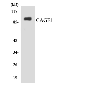 CAGE1 / Cancer Antigen 1 Antibody - Western blot analysis of the lysates from HepG2 cells using CAGE1 antibody.