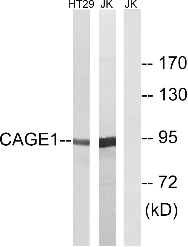 CAGE1 / Cancer Antigen 1 Antibody - Western blot analysis of lysates from HT-29 and Jurkat cells, using CAGE1 Antibody. The lane on the right is blocked with the synthesized peptide.