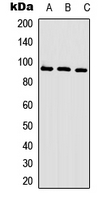 CAGE1 / Cancer Antigen 1 Antibody - Western blot analysis of CAGE1 expression in HeLa (A); Jurkat (B); mouse brain (C) whole cell lysates.