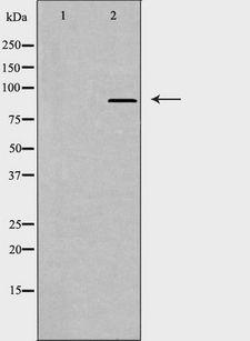 CAGE1 / Cancer Antigen 1 Antibody - Western blot analysis of extracts of HT29 cells using CAGE1 antibody.