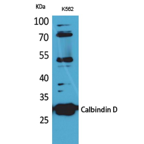 CALB1 / Calbindin Antibody - Western blot of Calbindin D28K antibody