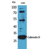 CALB1 / Calbindin Antibody - Western blot of Calbindin D28K antibody