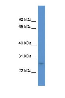 CALB1 / Calbindin Antibody - CALB1 / Calbindin antibody Western blot of COL0205 Cell lysate. Antibody concentration 1 ug/ml.  This image was taken for the unconjugated form of this product. Other forms have not been tested.