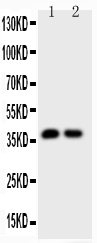 CALB1 / Calbindin Antibody - Western blot - Anti-Calbindin Picoband Antibody